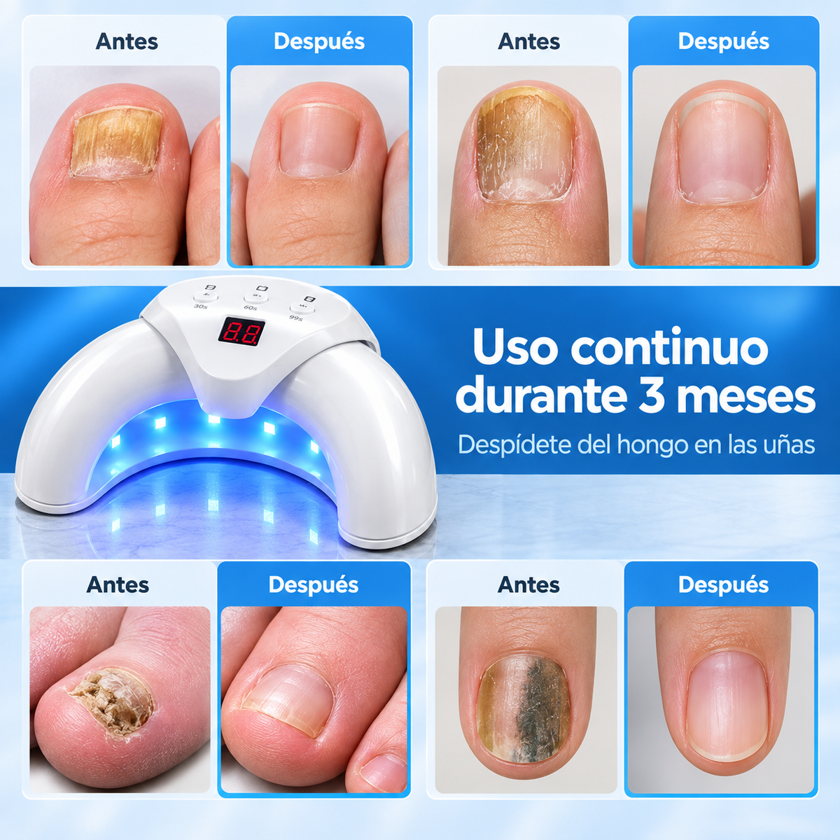 Nail Light™ – Cuidado de Uñas LED